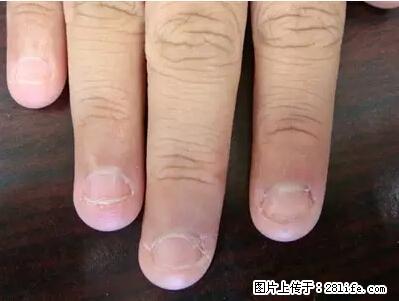 剪指甲、挖耳屎,这些日常小动作竟隐藏大危害! - 甘南生活资讯 - 甘南28生活网 gn.28life.com